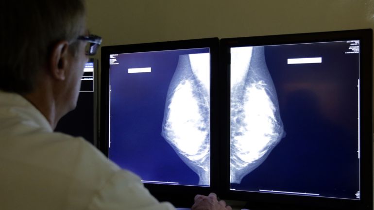 bfc1a343-21b3-4452-8067-1cfb83caca74 A radiologist examines breast X-rays after a regular cancer prevention medical check-up at a radiology center in Nice, November 5, 2012. REUTERS/Eric Gaillard (FRANCE - Tags: HEALTH SCIENCE TECHNOLOGY)