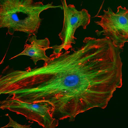 fluorescentcells-1791307325 صورة حقيقية لخلايا تحت المجهر الفلوري، تظهر فيها النواة والأنابيب الدقيقة والأكتين بألوان مختلفة