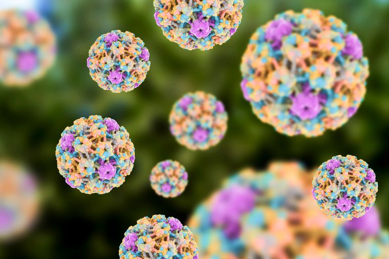 gettyimages-685029949-1756064507 Human papilloma virus (HPV), computer illustration. HPV causes warts, which mostly occur on the hands and feet. Certain strains also infect the genitals. Although most warts are non-malignant (not cancerous), some strains of HPV have been associated with cancers, especially cervical cancer.